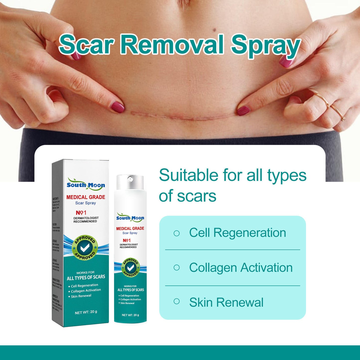 ✨ Regain Your Confidence – Fade Scars Fast with South Moon Medical Grade Scar Spray!