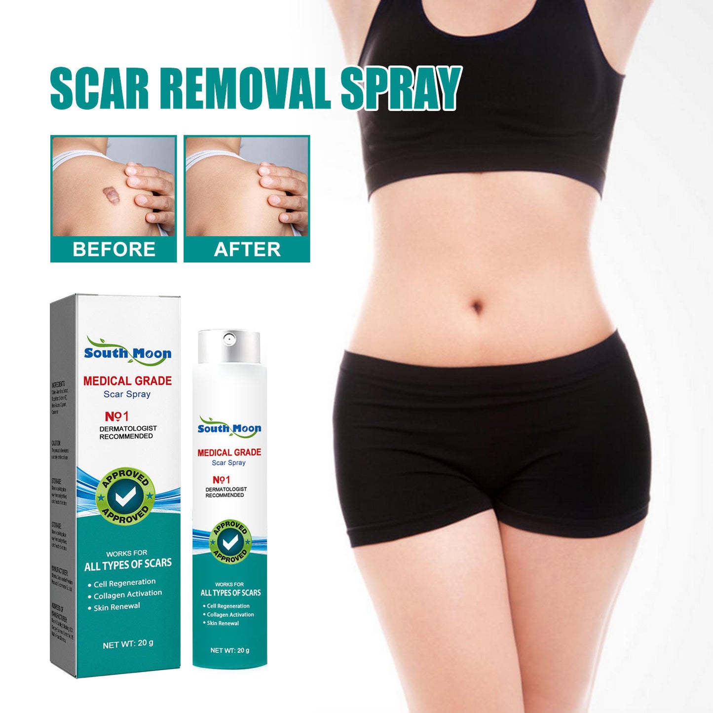 ✨ Regain Your Confidence – Fade Scars Fast with South Moon Medical Grade Scar Spray!